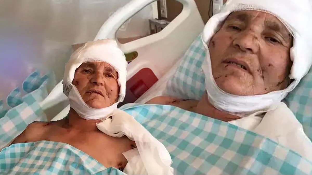 Sürü halinde köpeklerin saldırısına uğrayan yaşlı kadına rekor tazminat: Yargıtay kararı onadı