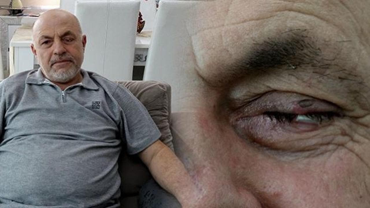 Trabzon'da tıbbi ihmal iddiası: Gözlükten kurtulmak isterken sol gözünü kaybetti