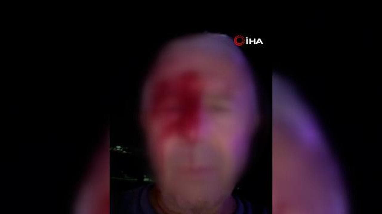 Haber takibi sırasında yumruklu saldırıya uğrayan muhabir yaralandı
