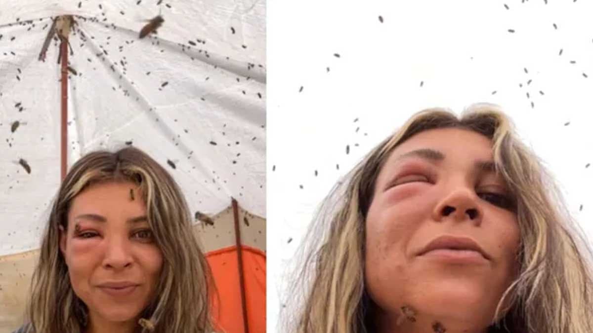 Arı kovanına yaklaşmak isteyen adamın yüzü tanınmaz hale geldi