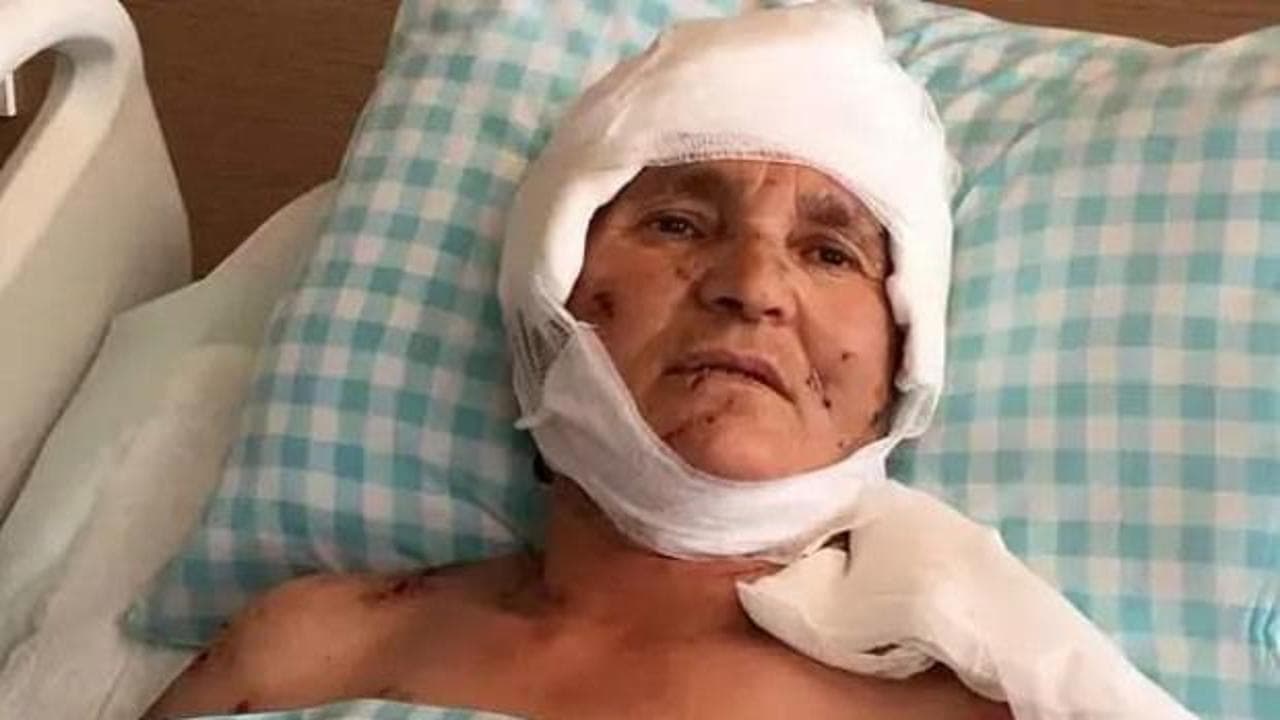 Kırşehir'de köpek saldırısına uğrayan yaşlı kadına rekor tazminat: Yargıtay onayladı
