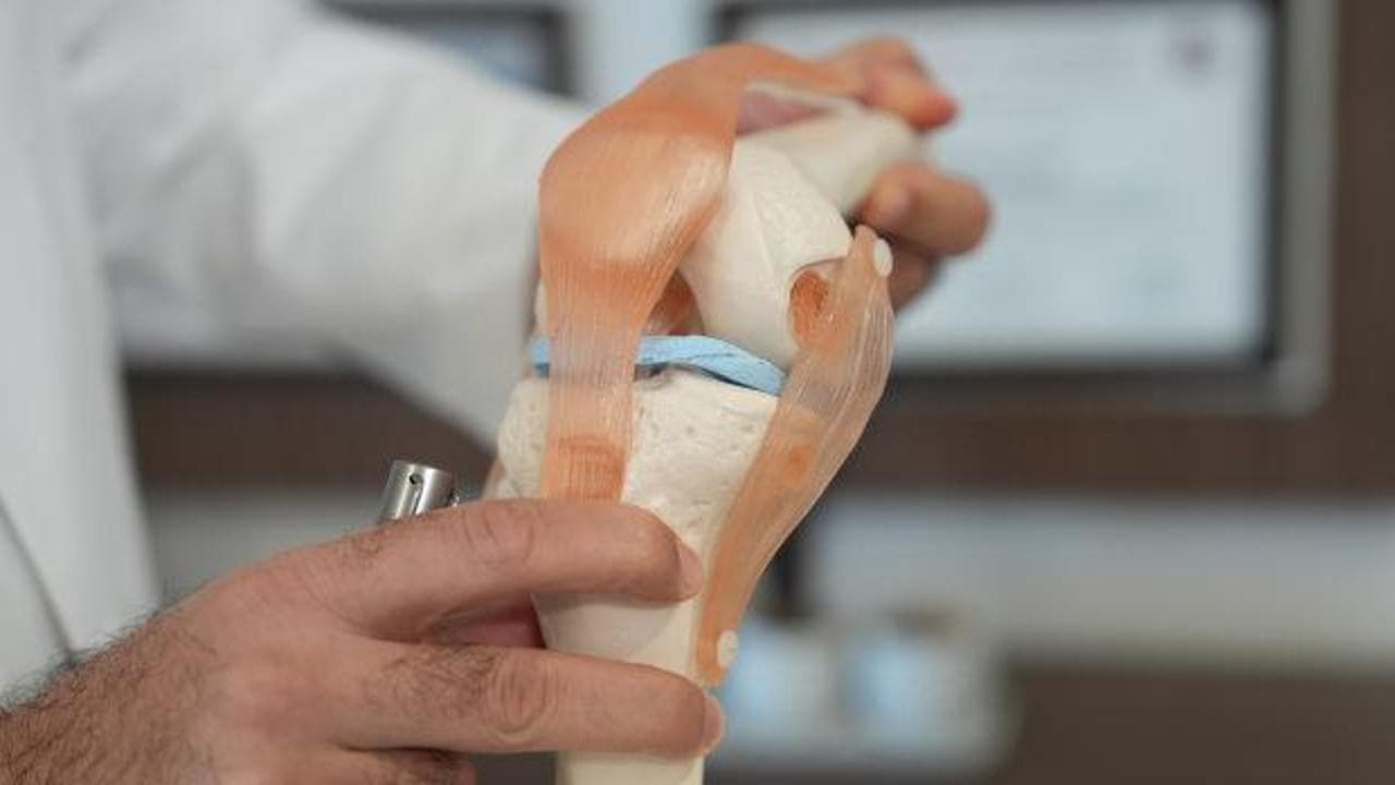 Menisküs kaybına hastanın kendi dokusundan kalıcı çözüm